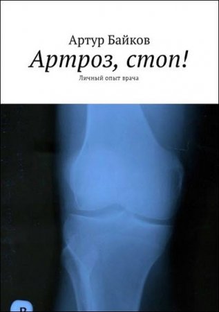 Обложка к Артроз, стоп! Личный опыт врача